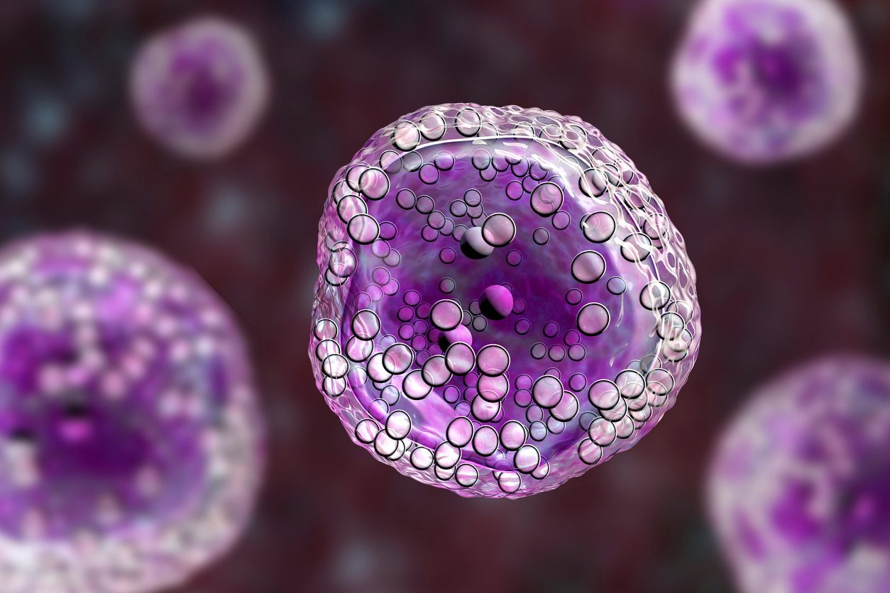 Illustration of B-cell lymphoma cell