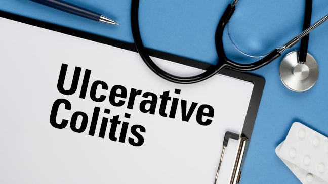 clipboard with ulcerative colitis written on the paper, with stethoscope and pen